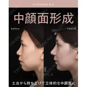 コントアクリニック 東京 石川 菜緒医師の症例
