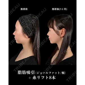 新宿美容外科ネビュラクリニック 山本 紘子医師の症例