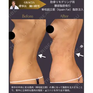 Casa de GRACIA GINZA 【カーサデグラシアギンザ】 樋口 隆男 理事長医師の症例