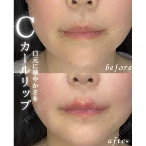 ルラライト美容クリニック 八王子院 桑野 淳医師の症例