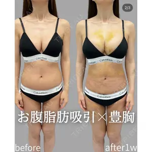 plume clinic 向山 綾子医師の症例