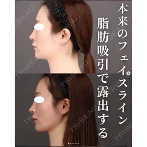 Casa de GRACIA GINZA 【カーサデグラシアギンザ】 吉田 直樹医師の症例
