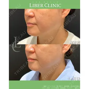 LIBER CLINIC 矢橋 洋一郎医師の症例