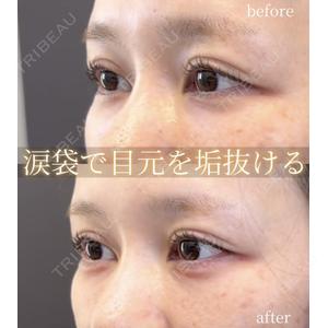 LA MER CLINIC 伊藤　整医師の症例