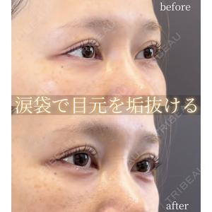 LA MER CLINIC 伊藤　整医師の症例