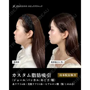 新宿美容外科ネビュラクリニック 山本 紘子医師の症例