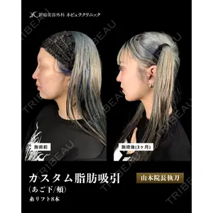 新宿美容外科ネビュラクリニック 山本 紘子医師の症例