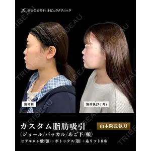 新宿美容外科ネビュラクリニック 山本 紘子医師の症例