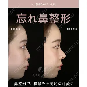 コントアクリニック 東京 石川 菜緒医師の症例