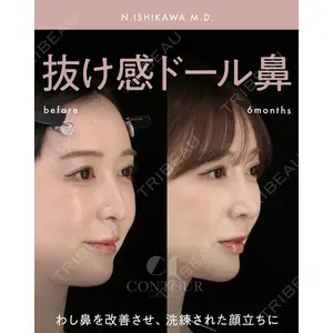 コントアクリニック 東京 石川 菜緒医師の症例