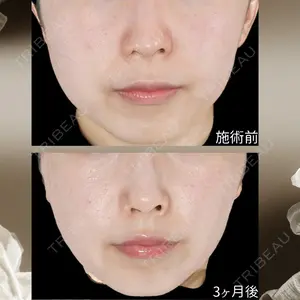 下北沢スキンクリニックの症例