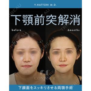 コントアクリニック 東京 服部 貴続医師の症例