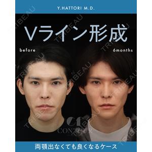 コントアクリニック 東京 服部 貴続医師の症例