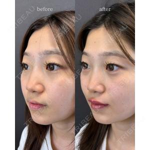 LA MER CLINIC 伊藤　整医師の症例