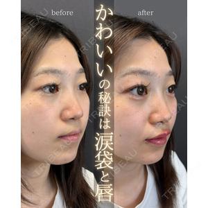 LA MER CLINIC 伊藤　整医師の症例