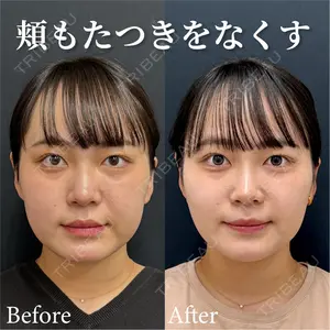 湘南美容クリニック 渋谷院 小草 智之医師の症例