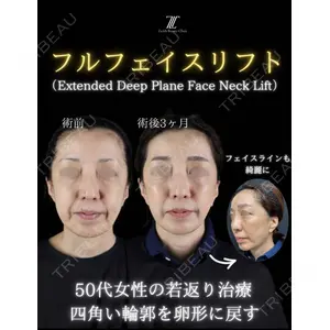 Zetith Beauty Clinic 新宿院 副島直人医師の症例