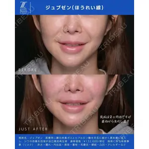 Zetith Beauty Clinic 新宿院 新井佑梨医師の症例