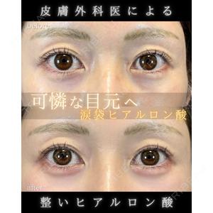 LA MER CLINIC 伊藤　整医師の症例