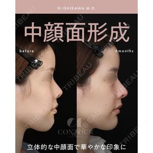 コントアクリニック 東京 石川 菜緒医師の症例