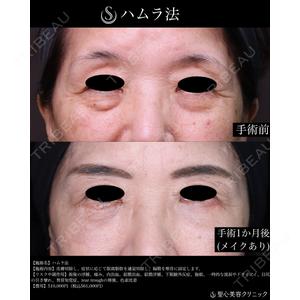 聖心美容クリニック 横浜院 川端 智貴医師の症例