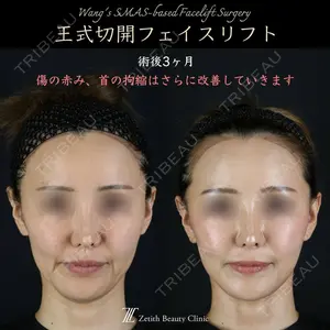 Zetith Beauty Clinic 新宿院 王 蘇医師の症例