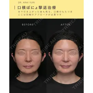 Zetith Beauty Clinic 新宿院 新井佑梨医師の症例