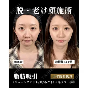 新宿美容外科ネビュラクリニック 山本 紘子医師の症例