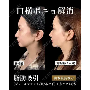 新宿美容外科ネビュラクリニック 山本 紘子医師の症例