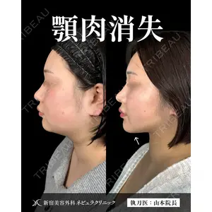 新宿美容外科ネビュラクリニック 山本 紘子医師の症例
