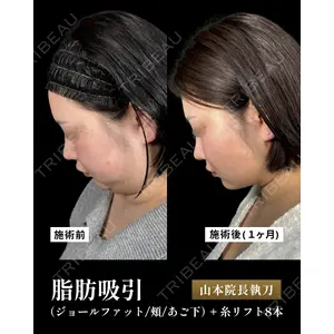 新宿美容外科ネビュラクリニック 山本 紘子医師の症例