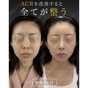 ルラ美容クリニック 渋谷本院 高塚 正己医師の症例