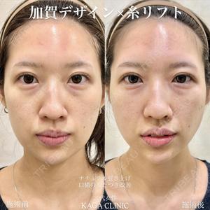 KAGA CLINIC 加賀 裕基医師の症例
