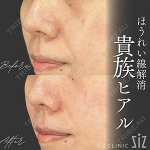 ziz CLINIC 村岡 史子医師の症例