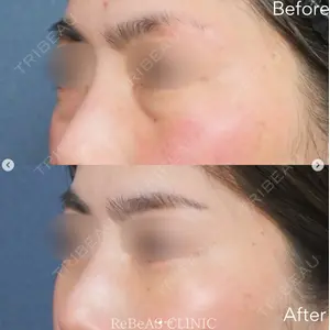 ReBeAS CLINICの症例