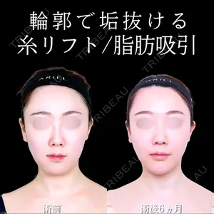 アリエル美容クリニック 大宮院 天白 典秀医師の症例