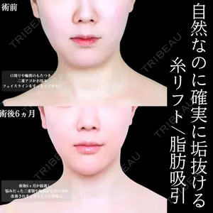 アリエル美容クリニック 大宮院 天白 典秀医師の症例