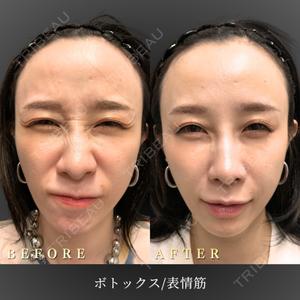 BiBiクリニック 山本 幸一郎医師の症例