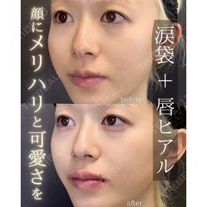 LA MER CLINIC 伊藤　整医師の症例