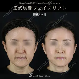 Zetith Beauty Clinic 新宿院 王 蘇医師の症例