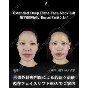 Zetith Beauty Clinic 新宿院 副島直人医師の症例