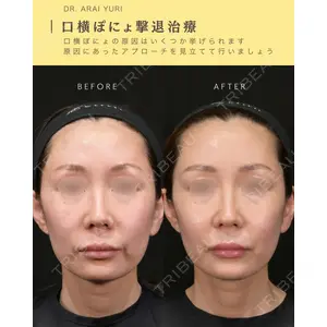 Zetith Beauty Clinic 新宿院 新井佑梨医師の症例