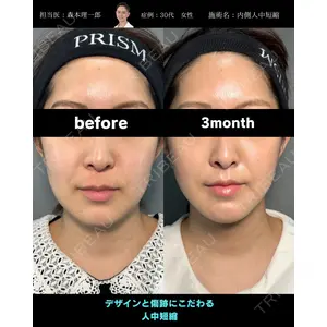 PRISM Beauty Clinic 町田院 森本 理一郎医師の症例