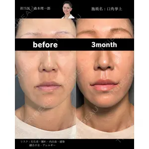 PRISM Beauty Clinic 町田院 森本 理一郎医師の症例