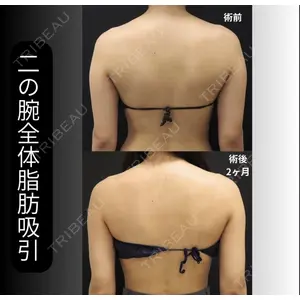 下北沢スキンクリニックの症例
