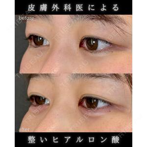 LA MER CLINIC 伊藤　整医師の症例