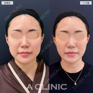 A CLINIC（エークリニック） 新宿院 瀬戸　翔太医師の症例
