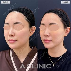 A CLINIC（エークリニック） 新宿院 瀬戸　翔太医師の症例