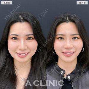 A CLINIC（エークリニック） 新宿院 瀬戸　翔太医師の症例