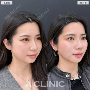 A CLINIC（エークリニック） 新宿院 瀬戸　翔太医師の症例